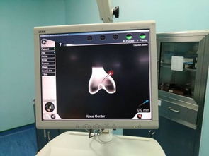 計(jì)算機(jī)輔助導(dǎo)航技術(shù)與移動(dòng)應(yīng)用在膝關(guān)節(jié)置換中的開(kāi)發(fā)與運(yùn)營(yíng)體會(huì)